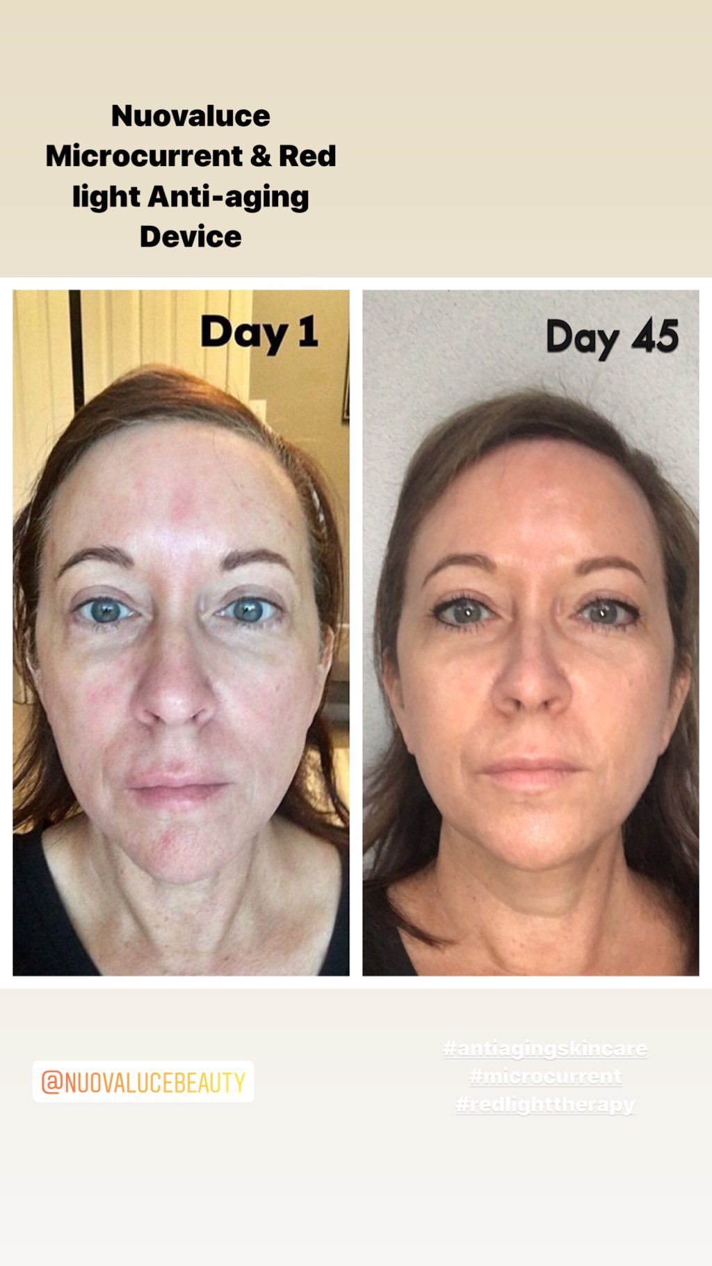 Nuovaluce customer before and after result 228