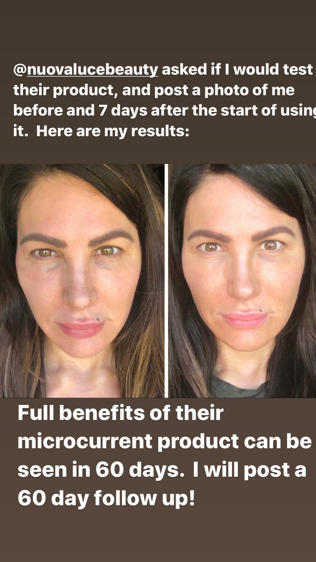Nuovaluce customer before and after result 229