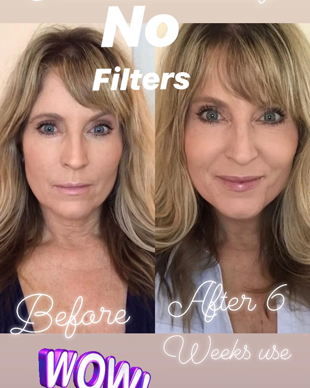Nuovaluce customer before and after result 230