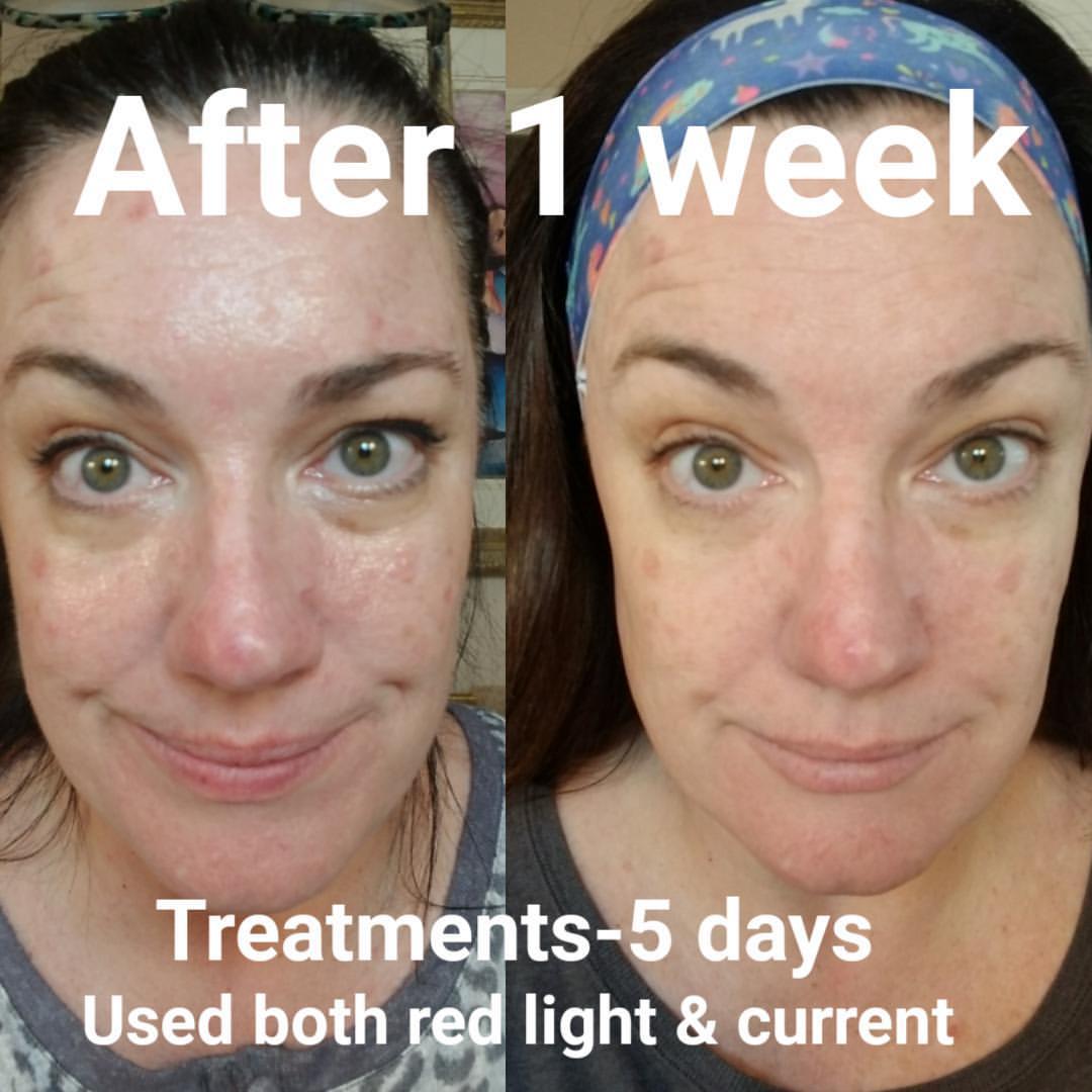 Nuovaluce customer before and after result 235