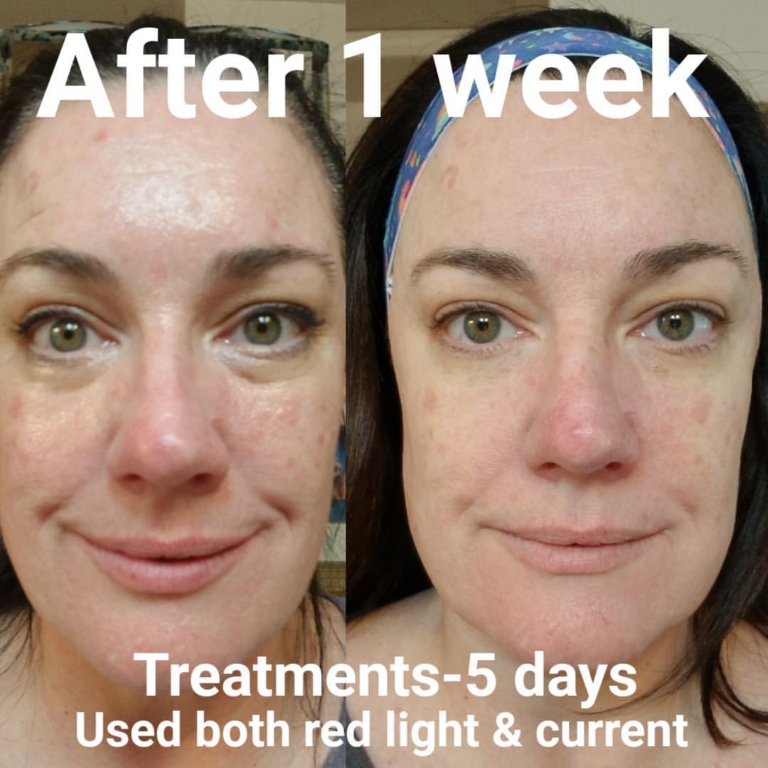 Nuovaluce customer before and after result 236