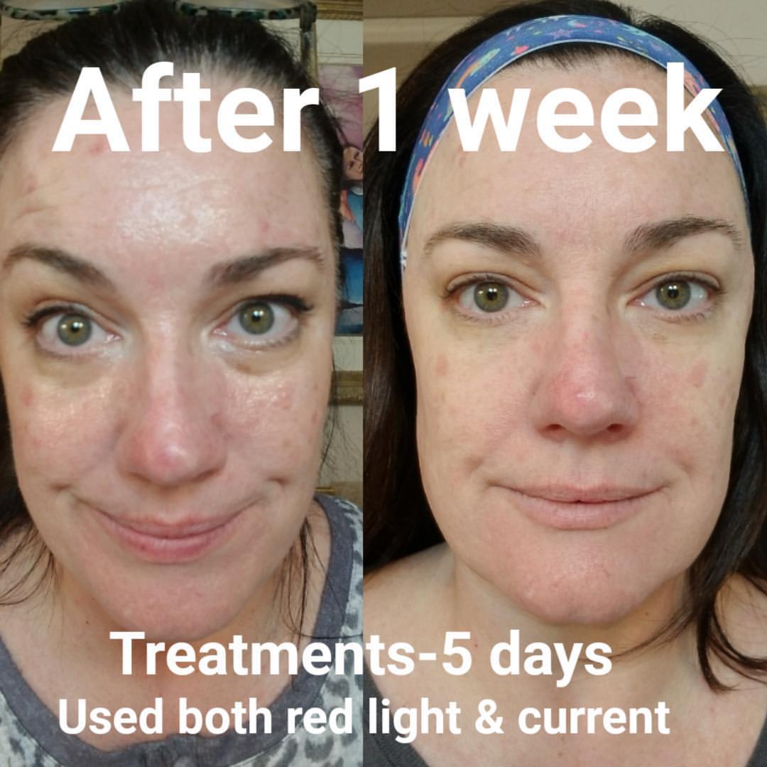 Nuovaluce customer before and after result 237