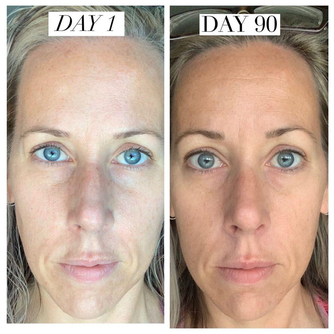 Nuovaluce customer before and after result 238