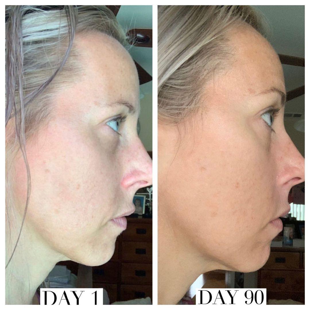 Nuovaluce customer before and after result 239