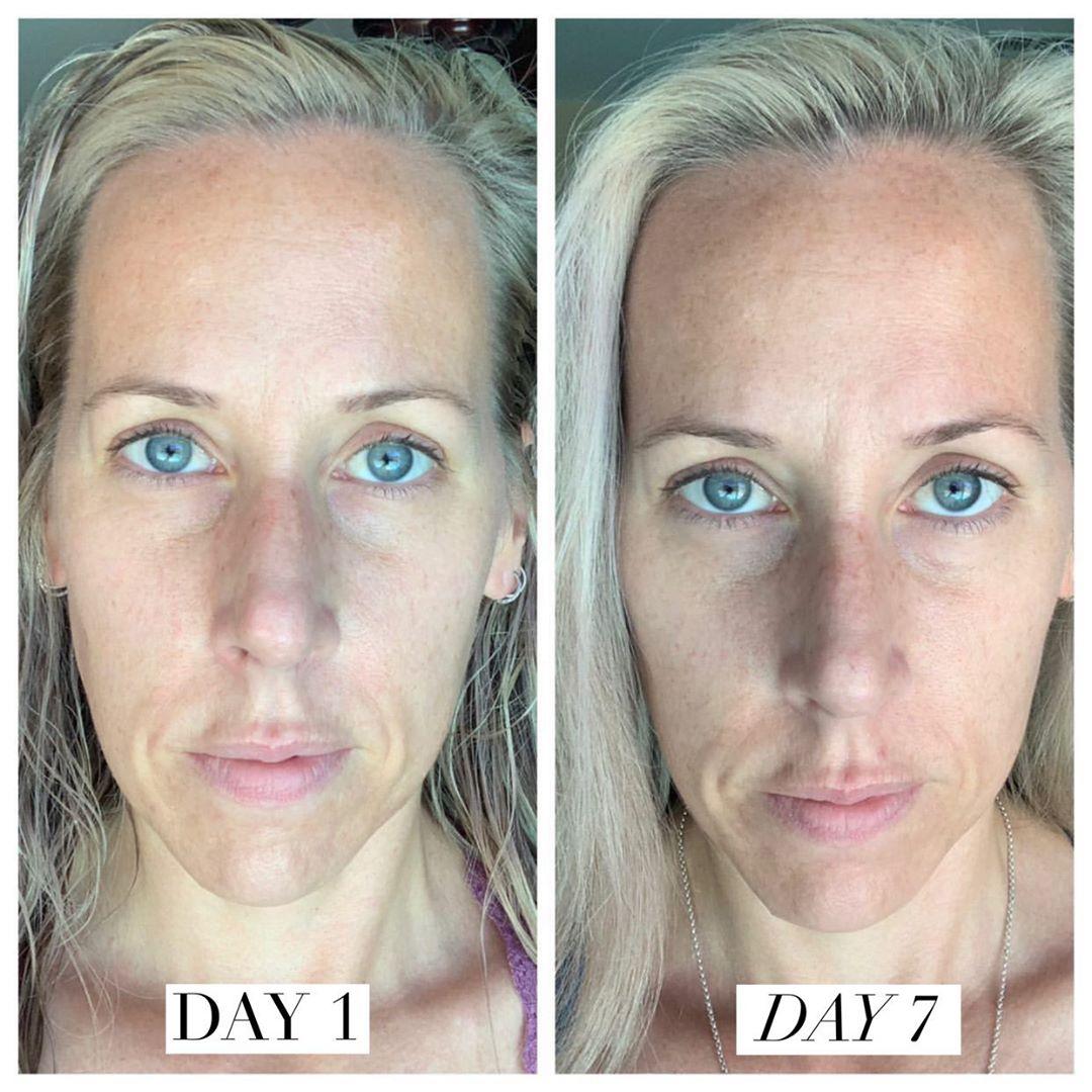 Nuovaluce customer before and after result 240