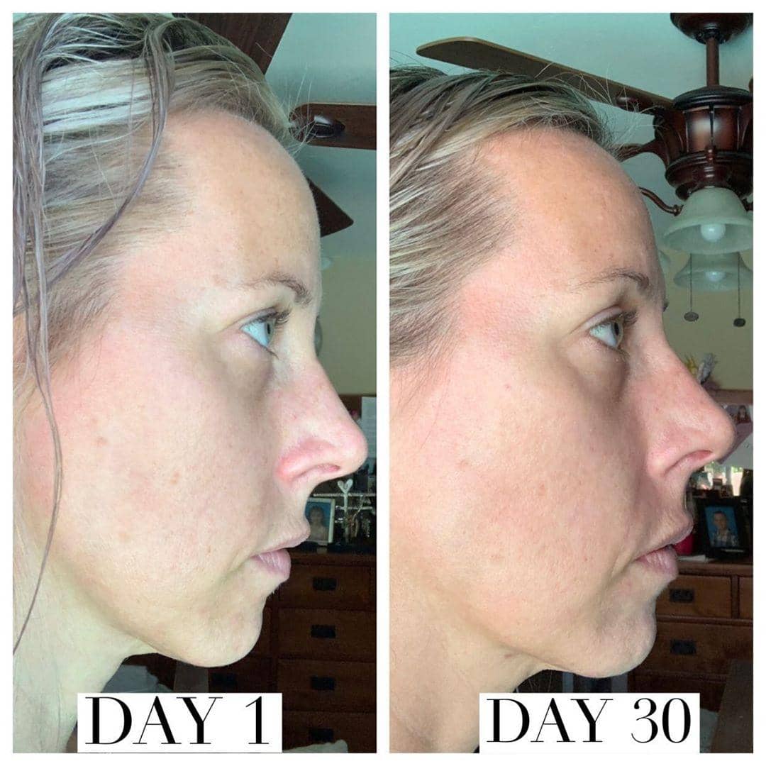 Nuovaluce customer before and after result 241
