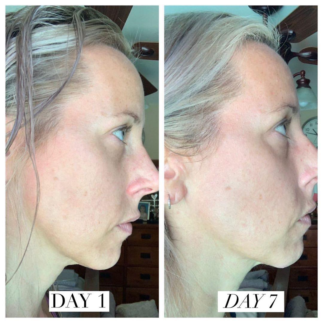Nuovaluce customer before and after result 242