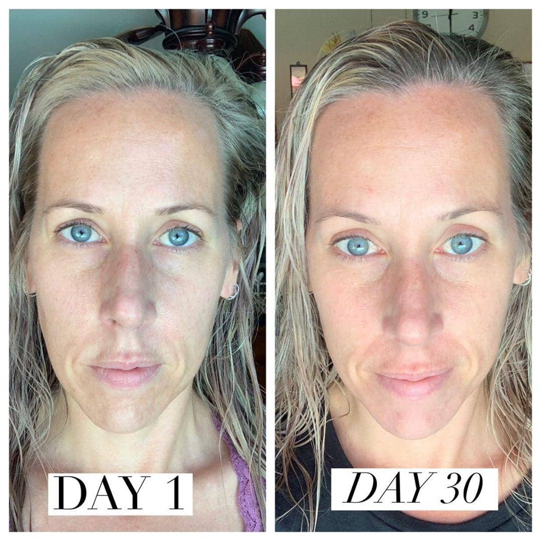 Nuovaluce customer before and after result 243