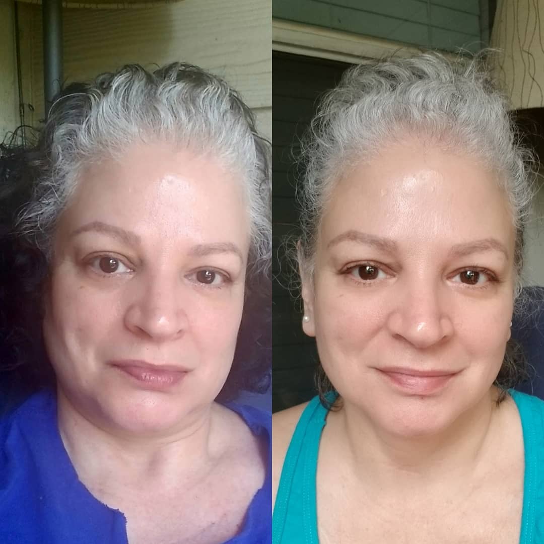 Nuovaluce customer before and after result 244