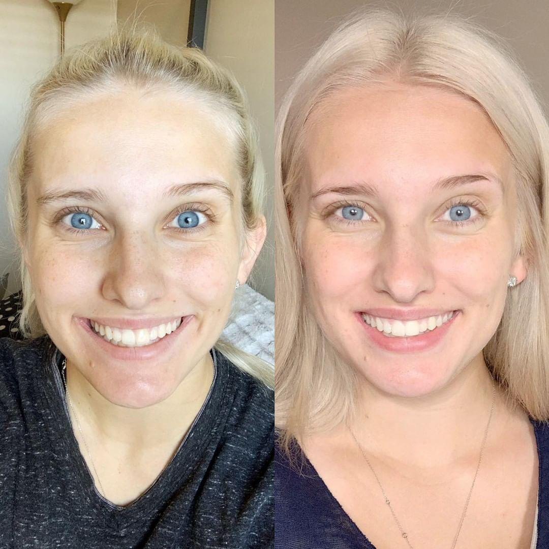Nuovaluce customer before and after result 245