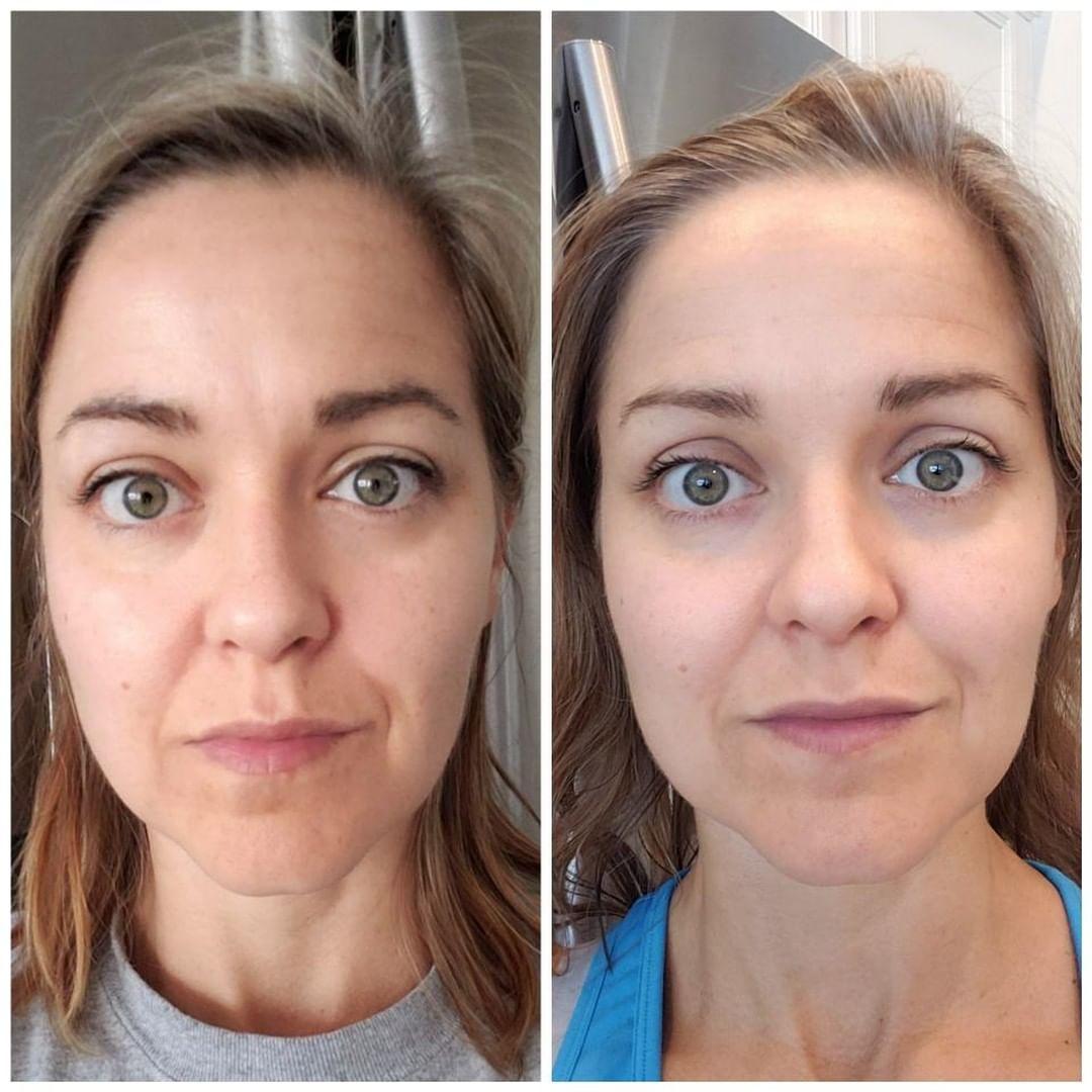 Nuovaluce customer before and after result 246