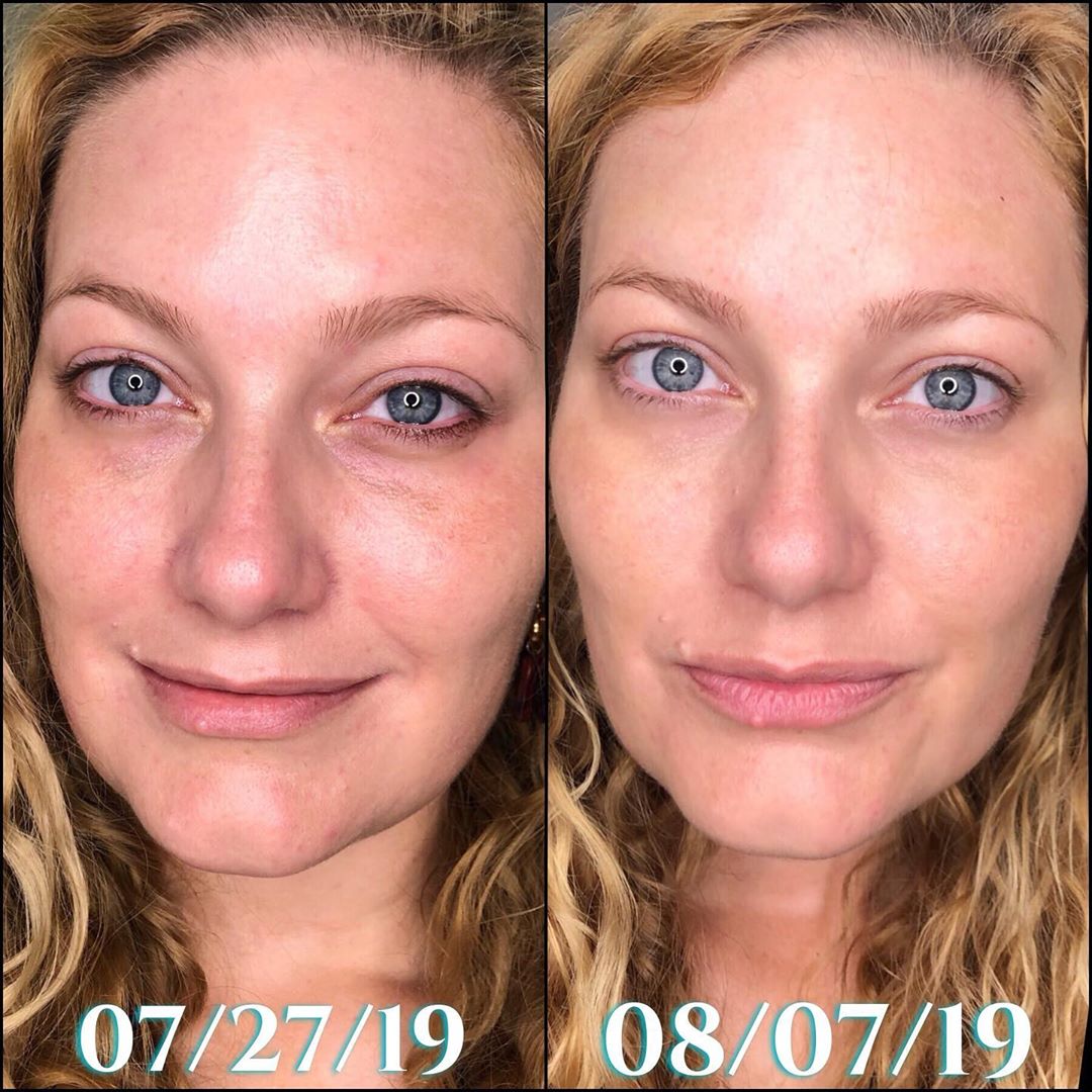Nuovaluce customer before and after result 247