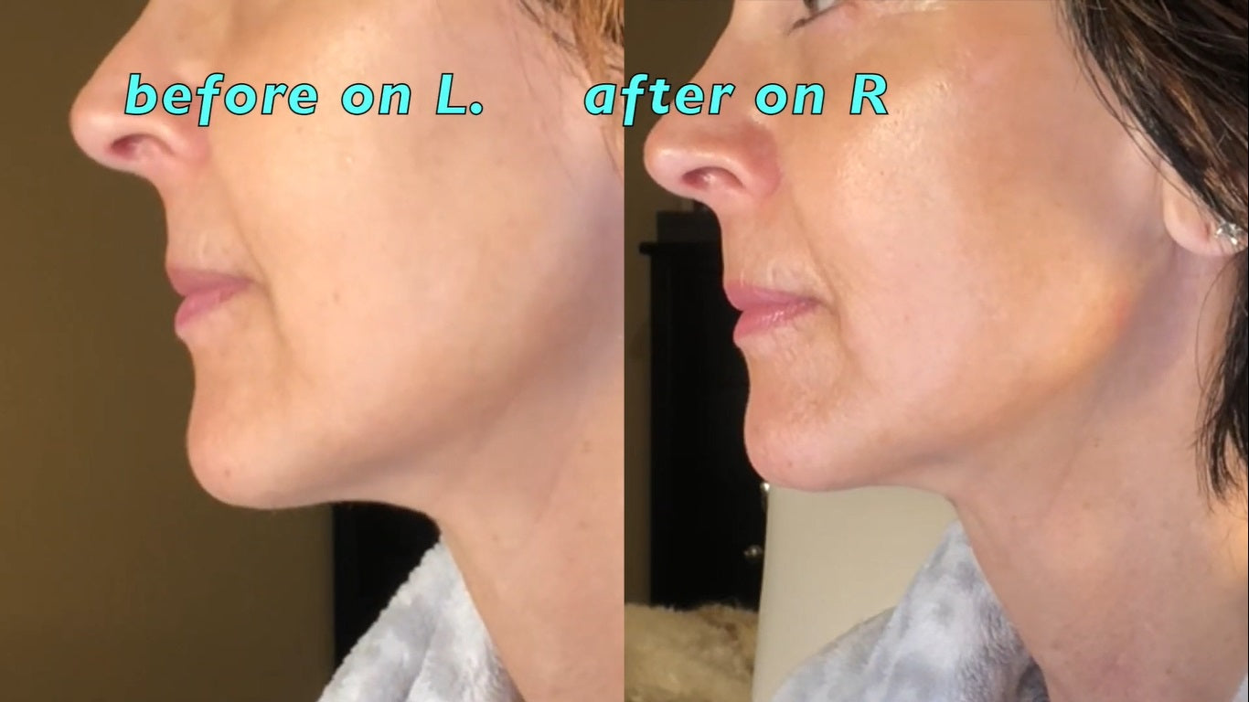 Nuovaluce customer before and after result 248