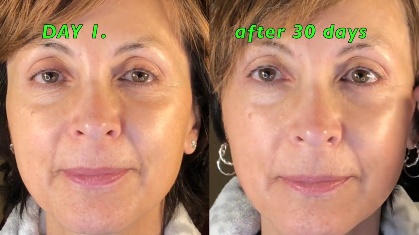 Nuovaluce customer before and after result 249