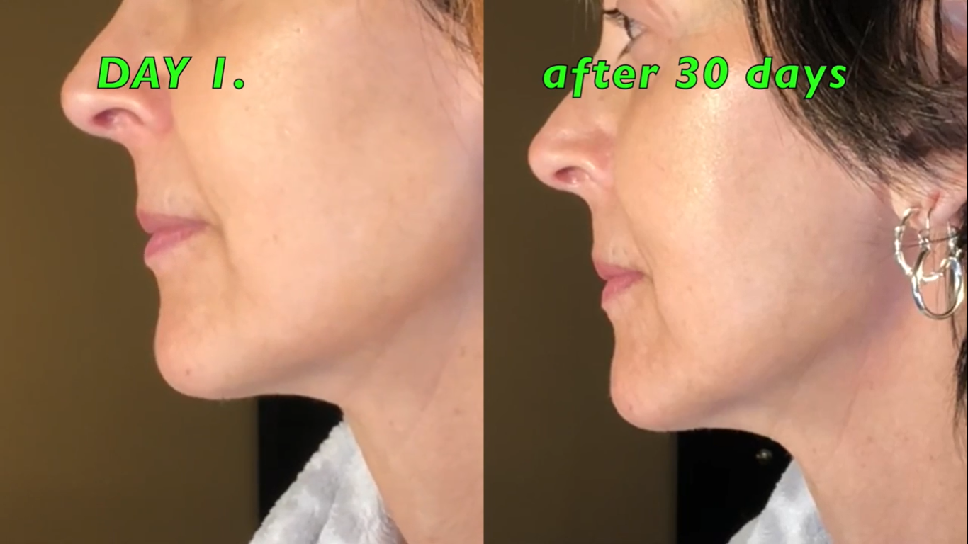 Nuovaluce customer before and after result 250