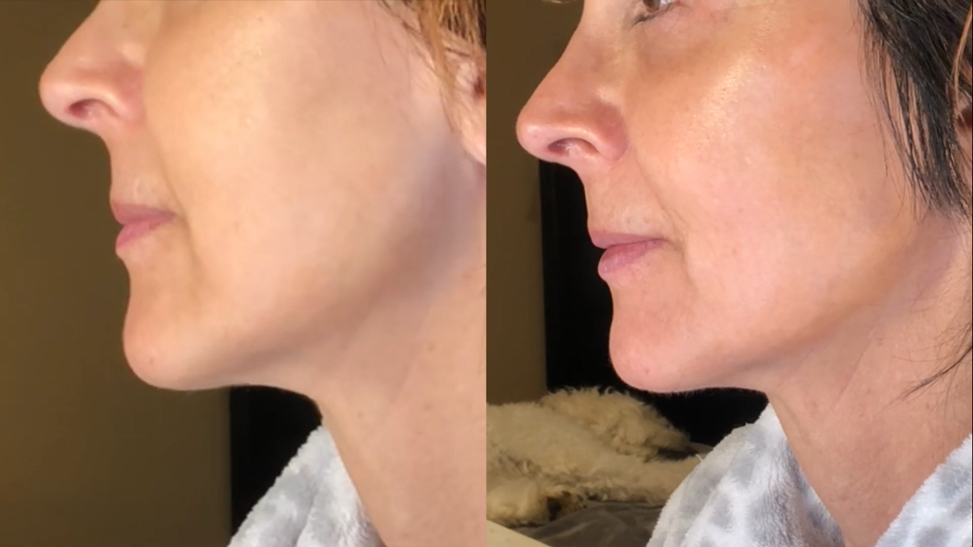 Nuovaluce customer before and after result 251