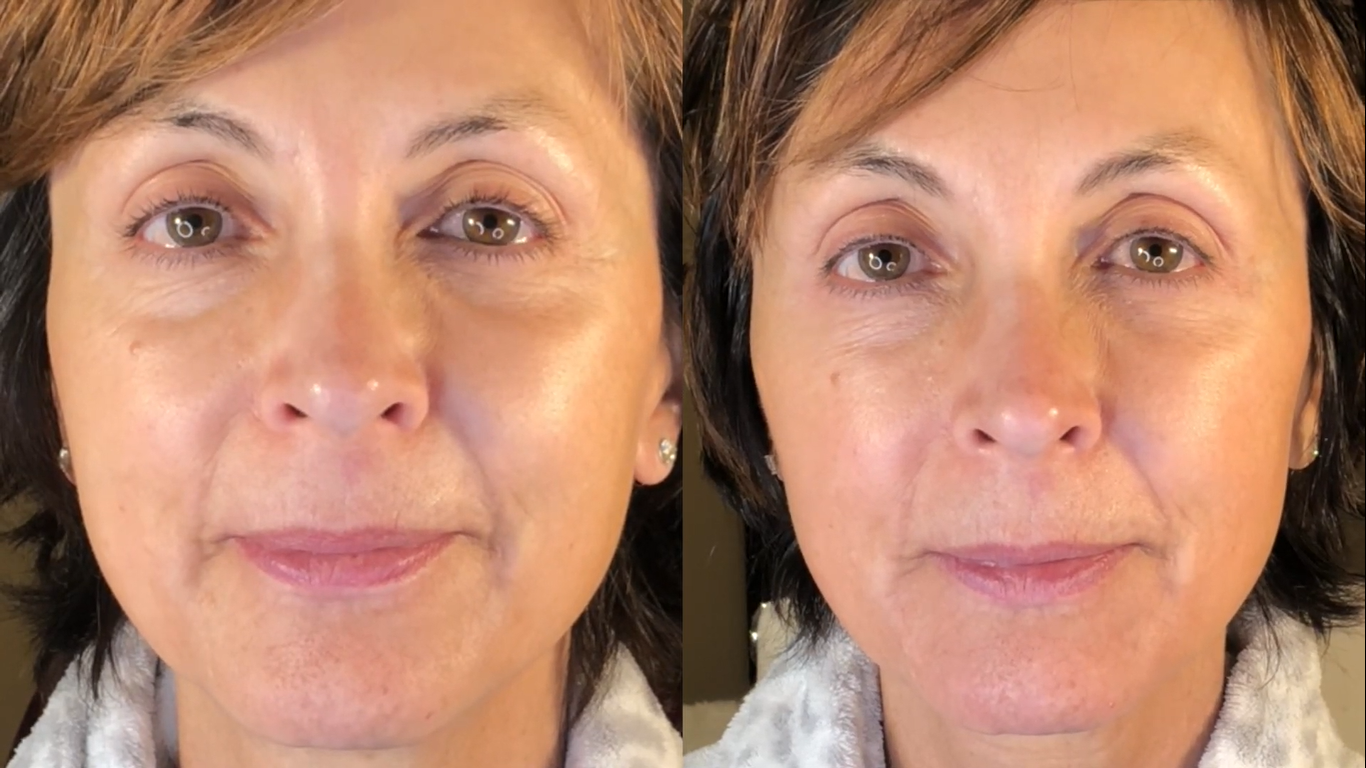 Nuovaluce customer before and after result 252