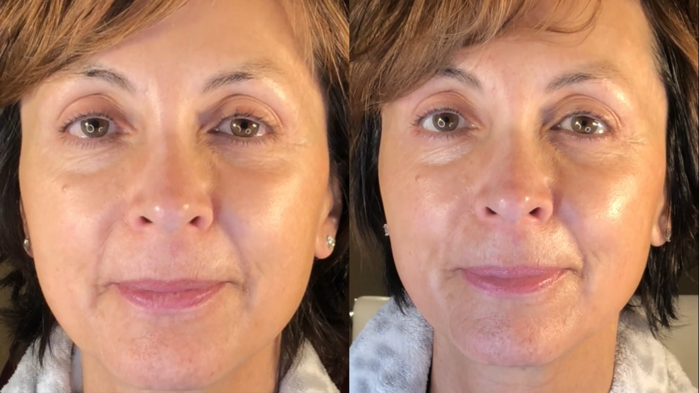 Nuovaluce customer before and after result 253