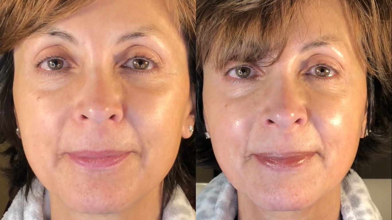 Nuovaluce customer before and after result 254