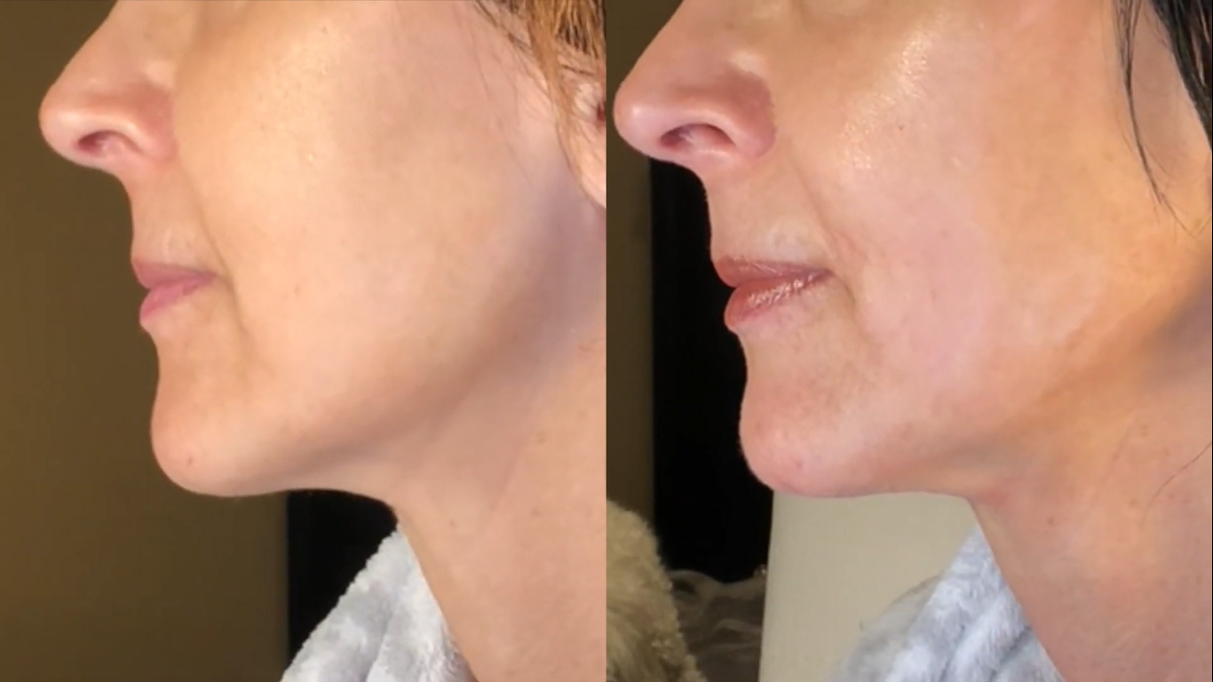 Nuovaluce customer before and after result 255