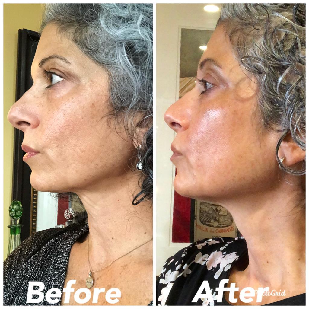 Nuovaluce customer before and after result 256