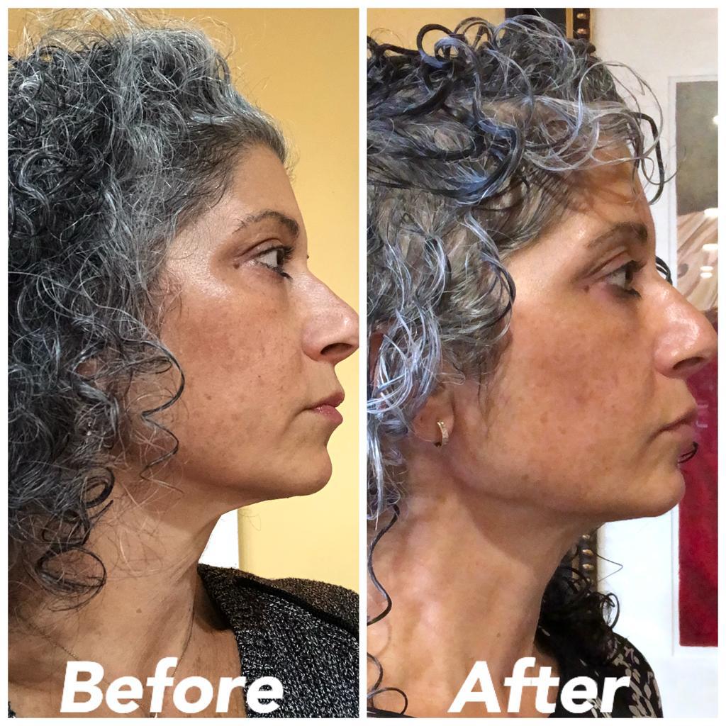 Nuovaluce customer before and after result 257