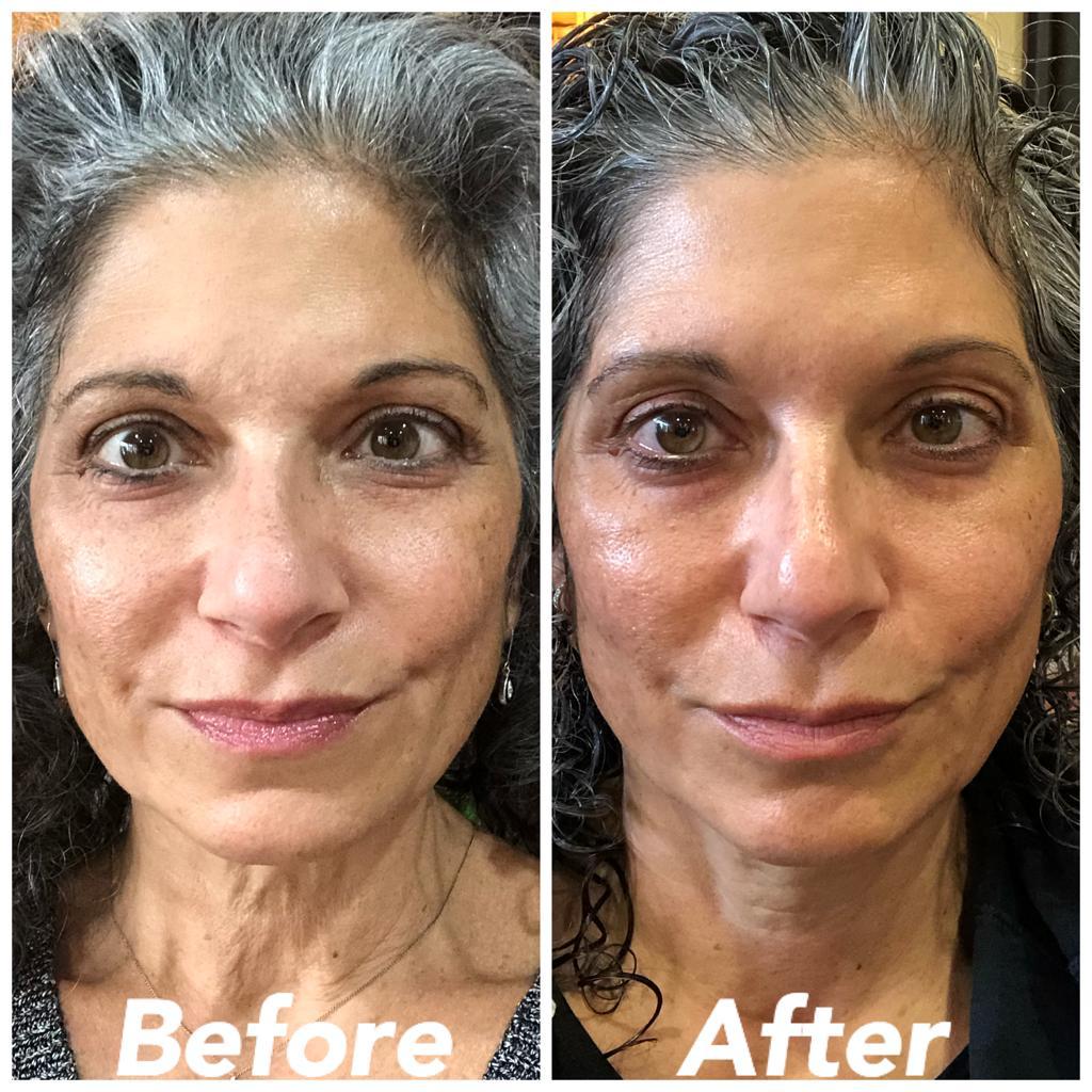 Nuovaluce customer before and after result 258