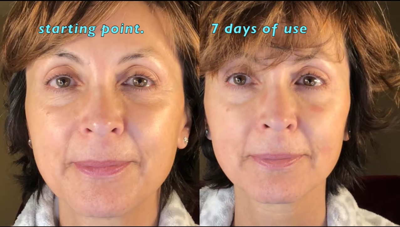 Nuovaluce customer before and after result 261