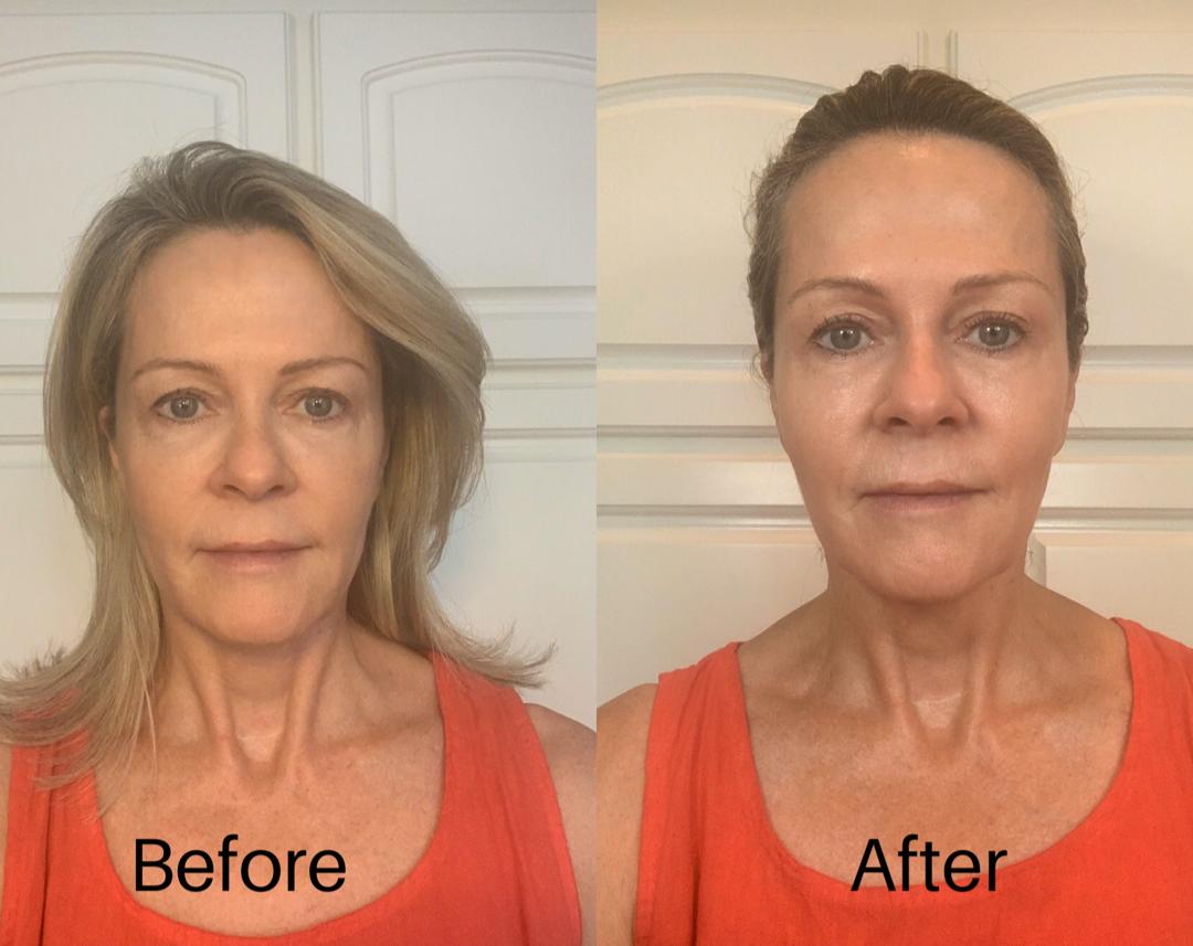 Nuovaluce customer before and after result 262