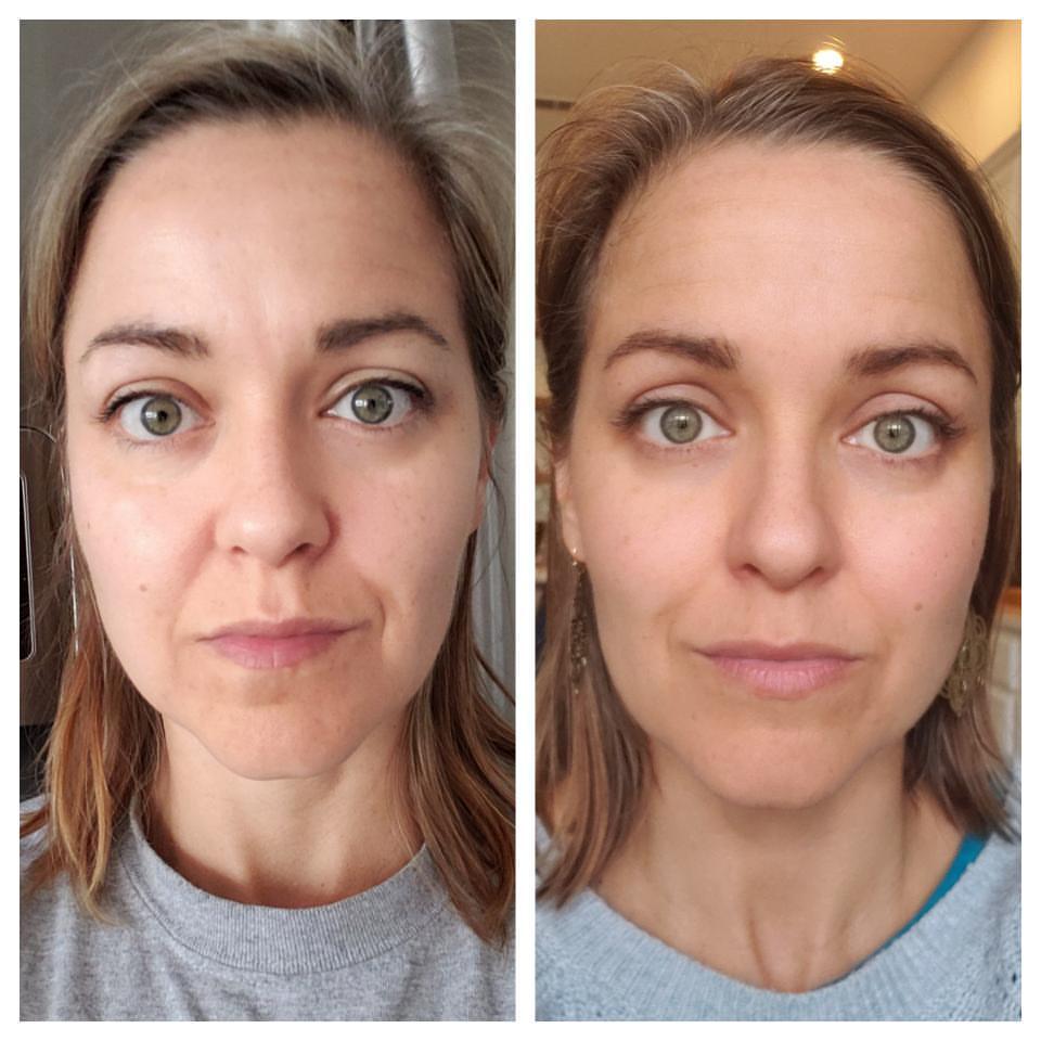 Nuovaluce customer before and after result 264