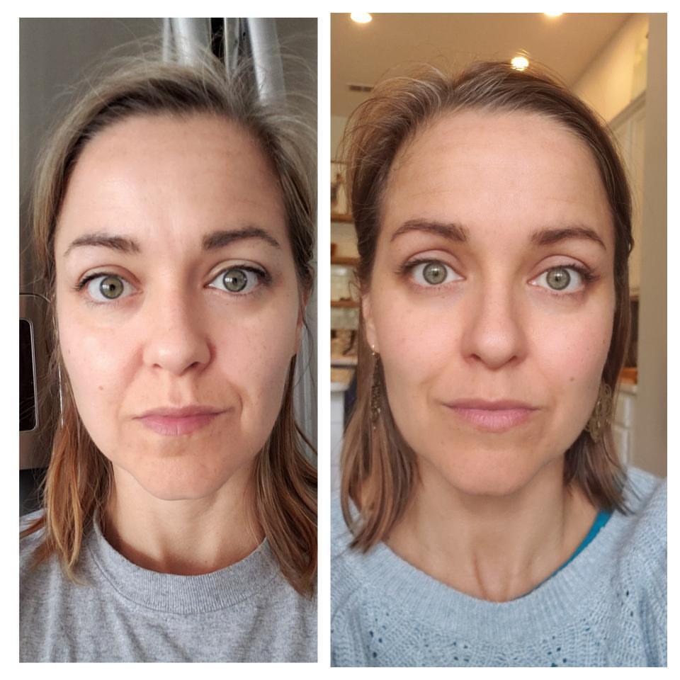 Nuovaluce customer before and after result 265