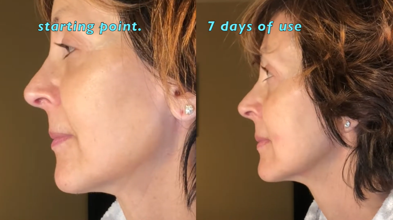Nuovaluce customer before and after result 266