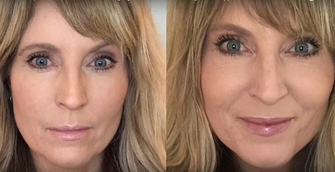 Nuovaluce customer before and after result 267