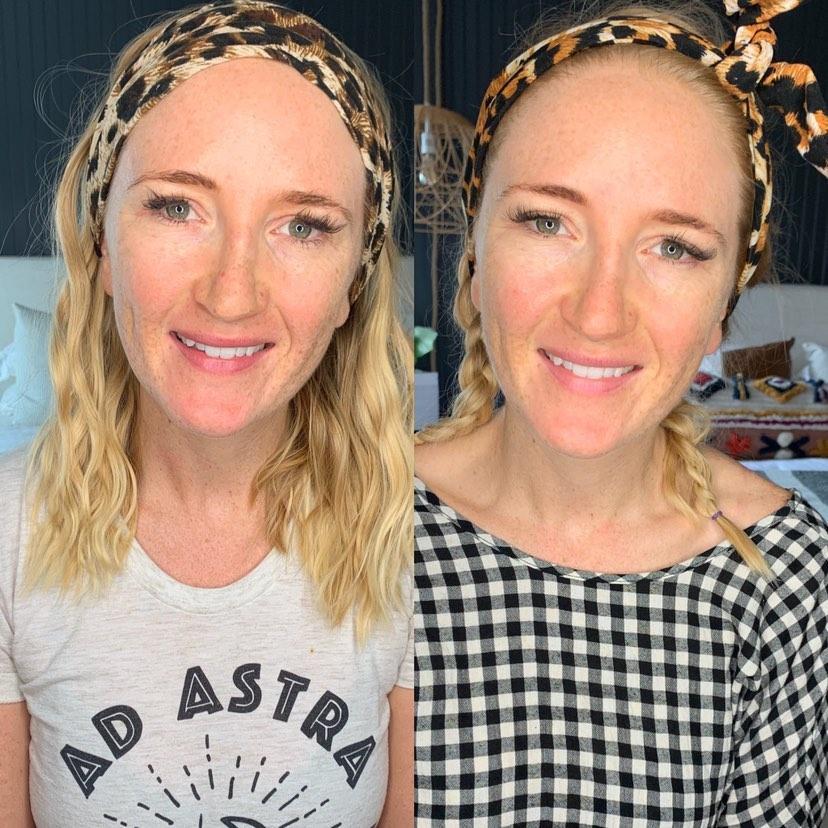 Nuovaluce customer before and after result 268