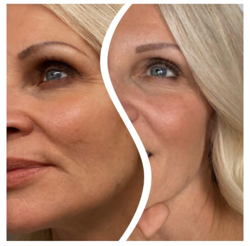 Nuovaluce customer before and after result 269