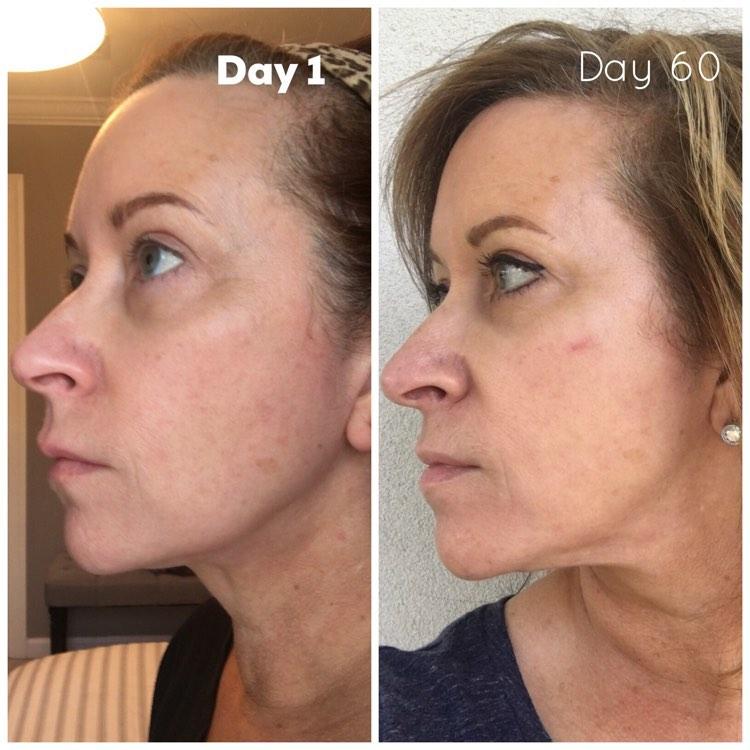 Nuovaluce customer before and after result 270