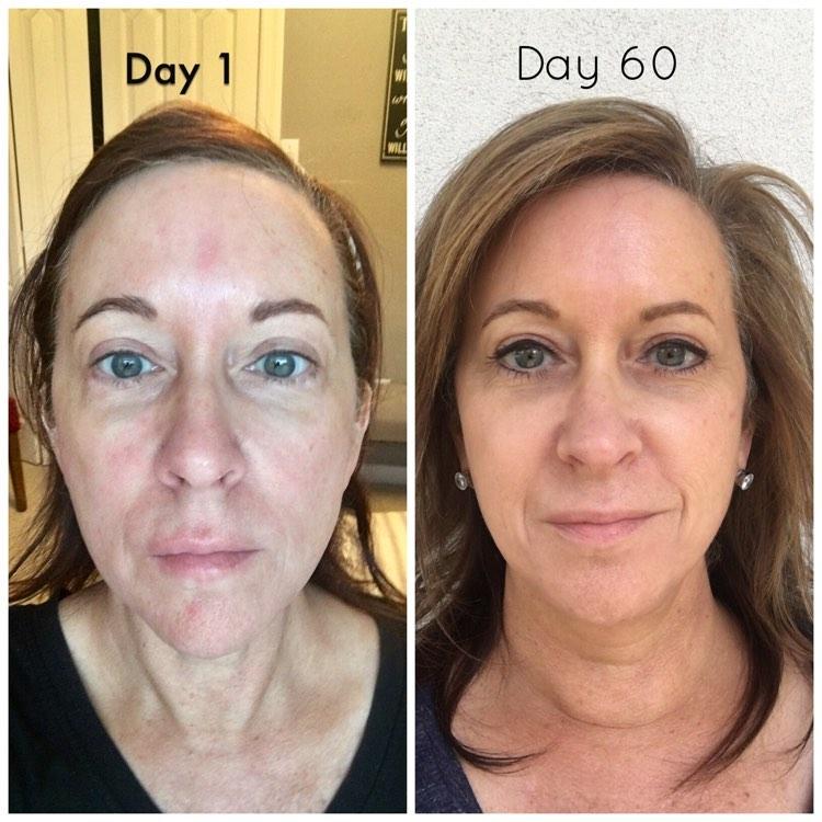 Nuovaluce customer before and after result 271
