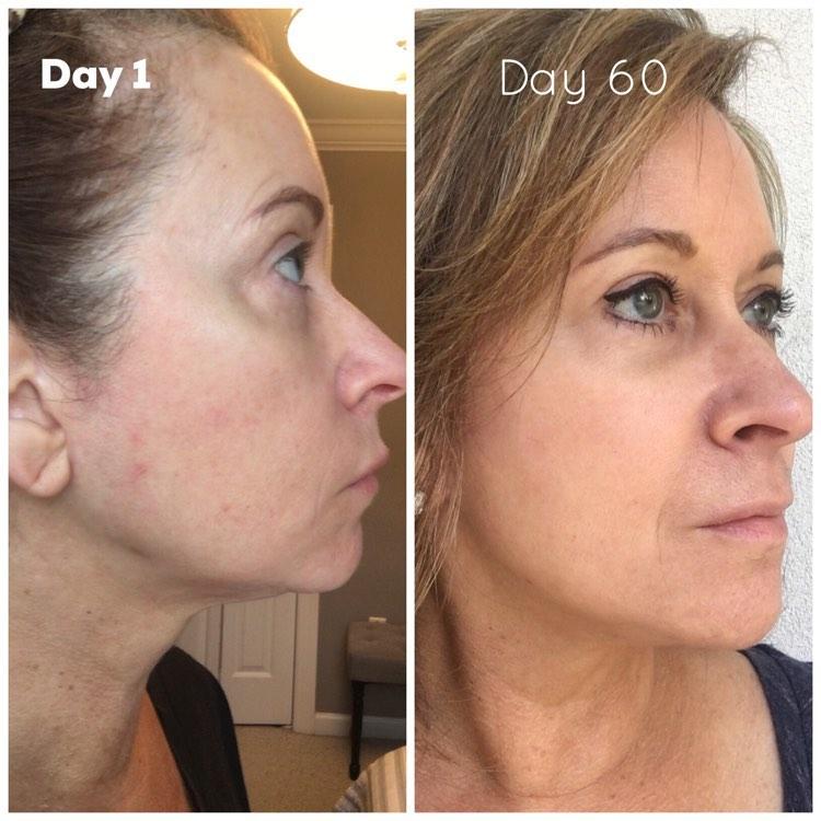 Nuovaluce customer before and after result 272