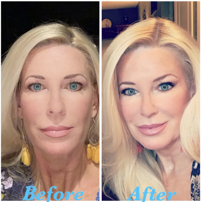 Nuovaluce customer before and after result 273