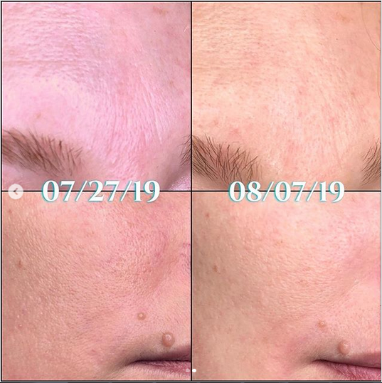 Nuovaluce customer before and after result 274