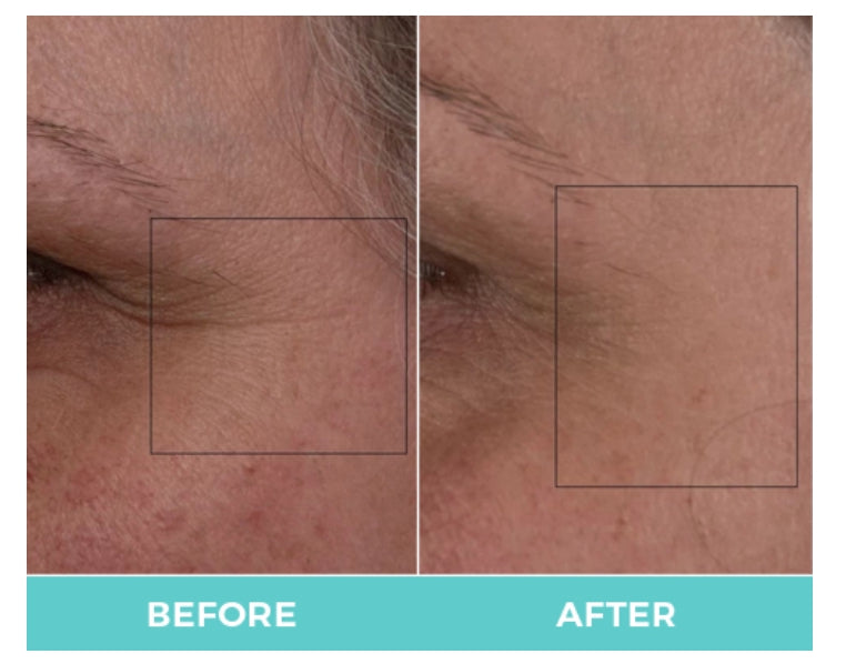 Nuovaluce customer before and after result 276