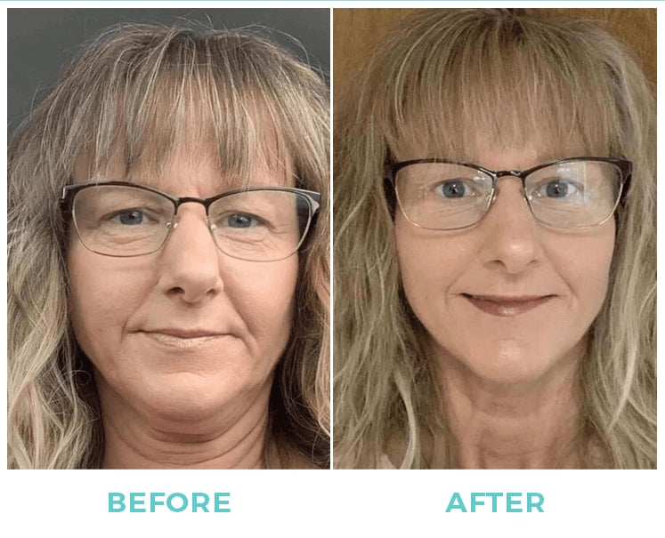 Nuovaluce customer before and after result 277