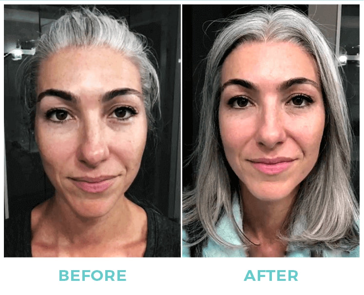 Nuovaluce customer before and after result 278