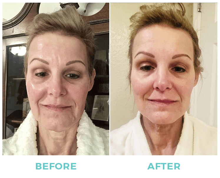 Nuovaluce customer before and after result 279