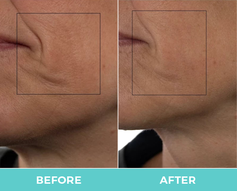 Nuovaluce customer before and after result 280