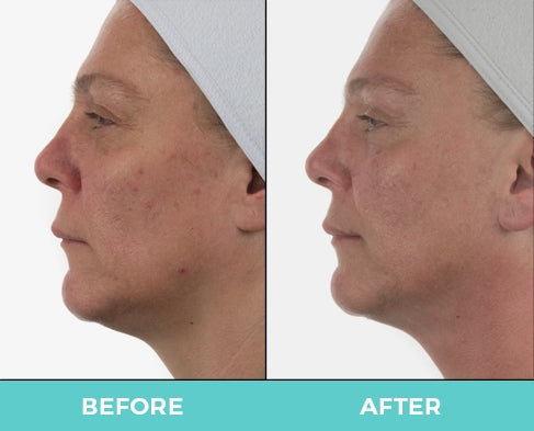 Nuovaluce customer before and after result 281