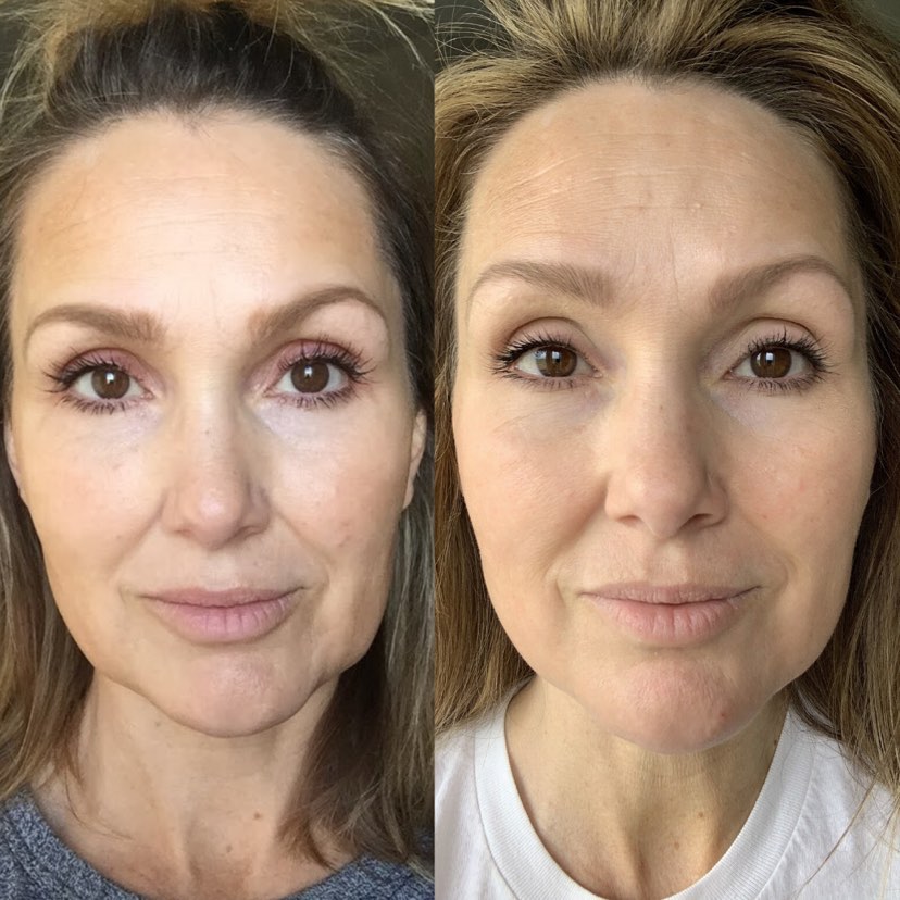 Nuovaluce customer before and after result 285