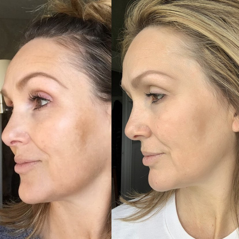 Nuovaluce customer before and after result 286