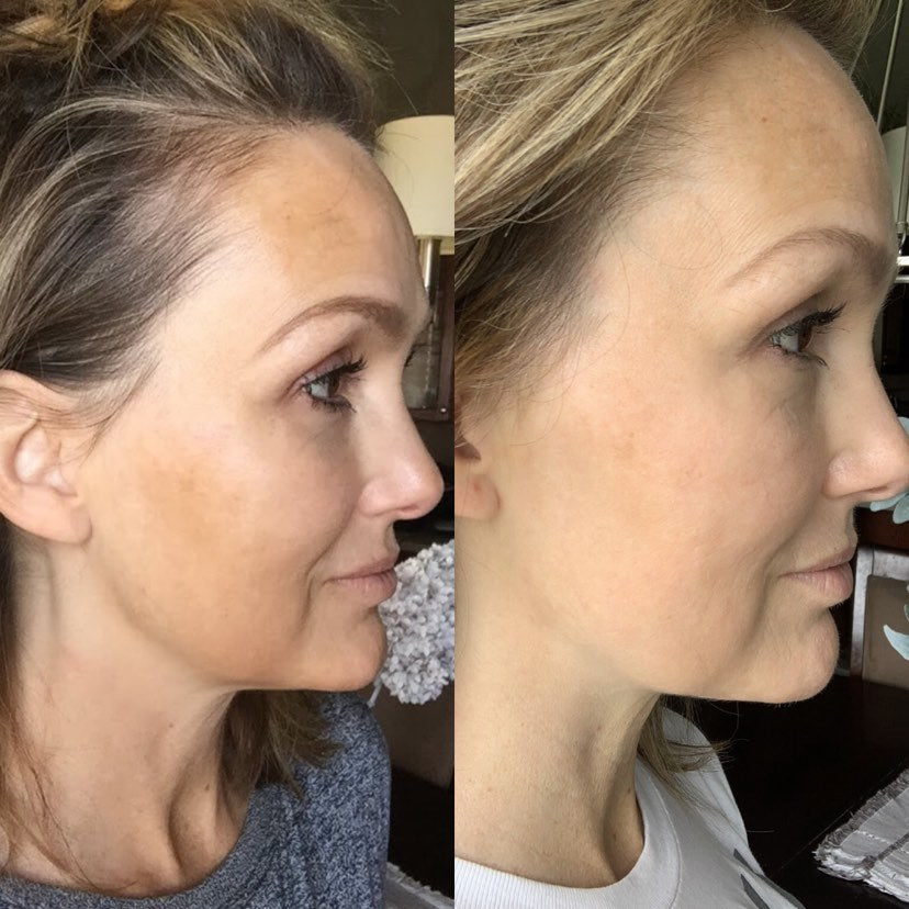 Nuovaluce customer before and after result 287