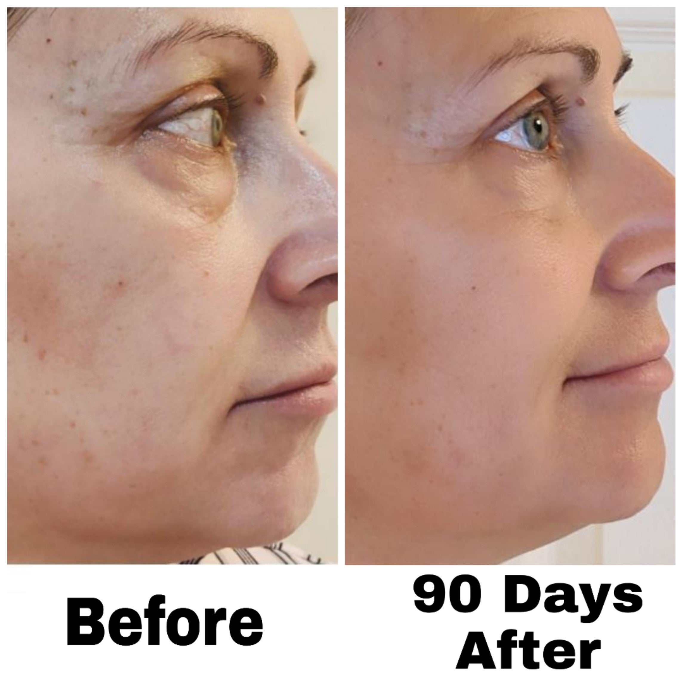 Nuovaluce customer before and after result 288